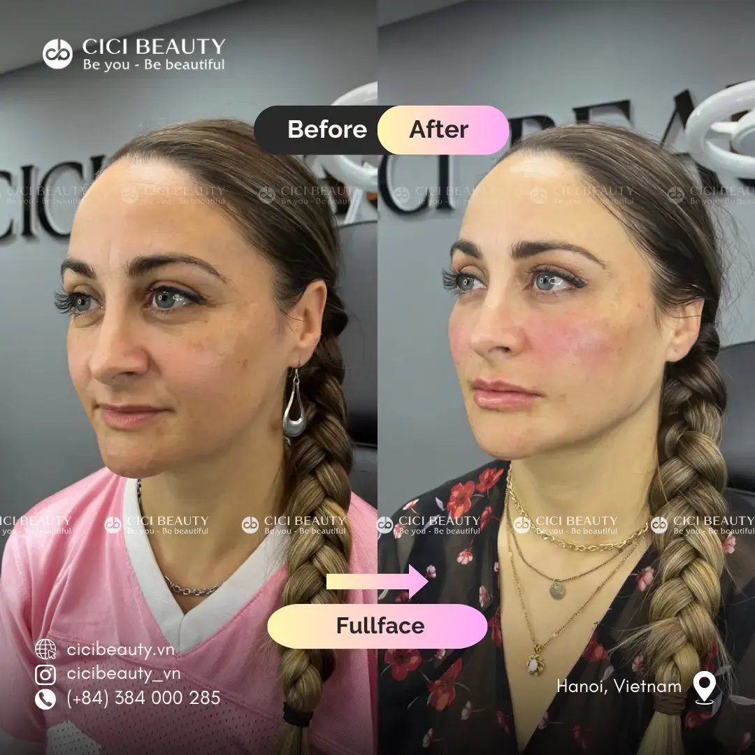 Fullface