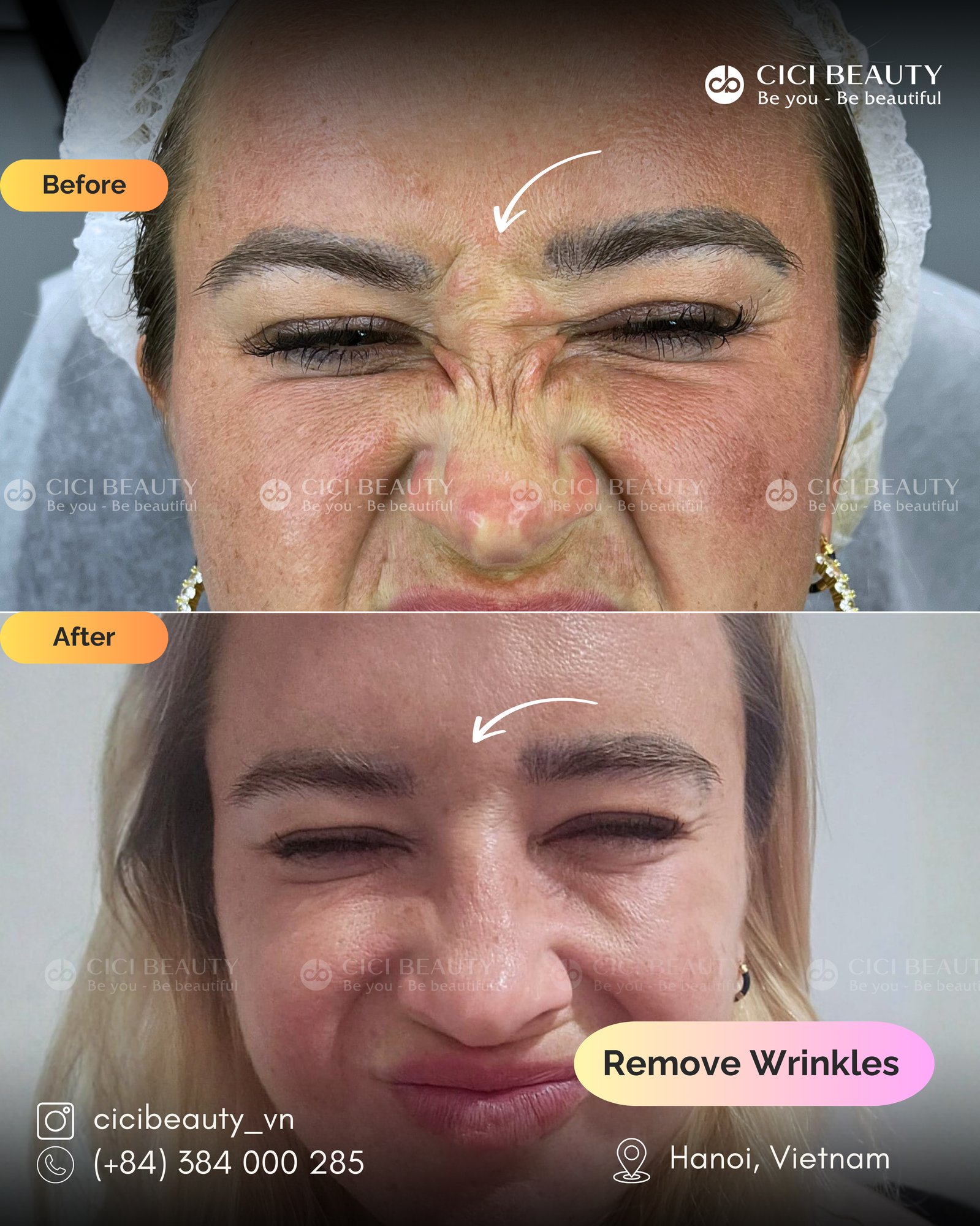 PBA_ Remove Wrinkles_Gabrielle _2