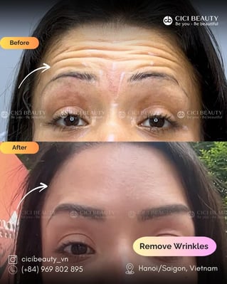 PBA_ Remove Wrinkles_Mae_3
